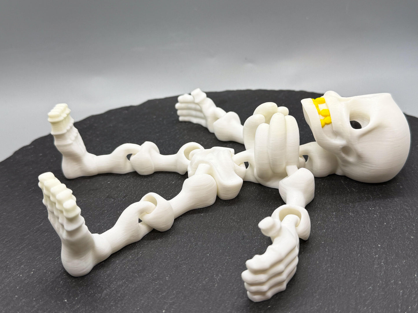 Chattering Skeleton